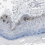 TACC3 Polyclonal Antibody