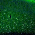 PCP4 Polyclonal Antibody