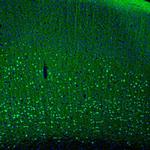 PCP4 Antibody in Immunohistochemistry (IHC)