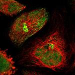 GRHL1 Polyclonal Antibody