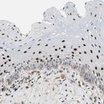 GRHL1 Antibody in Immunohistochemistry (Paraffin) (IHC (P))