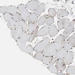 GRHL1 Antibody in Immunohistochemistry (Paraffin) (IHC (P))