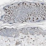 GRHL1 Antibody in Immunohistochemistry (Paraffin) (IHC (P))
