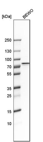 GRHL1 Antibody in Western Blot (WB)