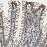 HEPH Polyclonal Antibody