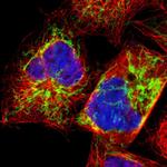 EXD2 Polyclonal Antibody