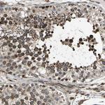 EXD2 Antibody in Immunohistochemistry (Paraffin) (IHC (P))