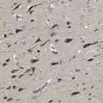 TRAK1 Antibody in Immunohistochemistry (Paraffin) (IHC (P))