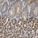 TRAK1 Antibody in Immunohistochemistry (Paraffin) (IHC (P))