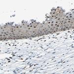 POLR3K Polyclonal Antibody