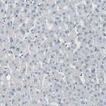 POLR3K Antibody in Immunohistochemistry (Paraffin) (IHC (P))