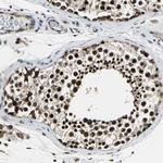 POLR3K Antibody in Immunohistochemistry (Paraffin) (IHC (P))