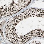 POLR3K Antibody in Immunohistochemistry (IHC)