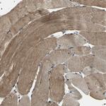 UCH37 Polyclonal Antibody