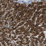 FAM65A Antibody in Immunohistochemistry (Paraffin) (IHC (P))