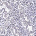 MYOM2 Antibody in Immunohistochemistry (Paraffin) (IHC (P))