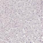 MYOM2 Antibody in Immunohistochemistry (Paraffin) (IHC (P))