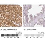 MYOM2 Antibody in Immunohistochemistry (IHC)