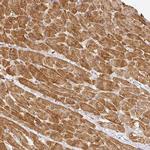 MYOM2 Antibody in Immunohistochemistry (IHC)
