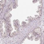 MYOM2 Antibody in Immunohistochemistry (IHC)