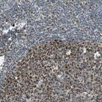HLX Antibody in Immunohistochemistry (Paraffin) (IHC (P))