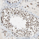 HLX Antibody in Immunohistochemistry (Paraffin) (IHC (P))