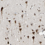 HLX Antibody in Immunohistochemistry (Paraffin) (IHC (P))