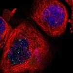 RPS13 Polyclonal Antibody