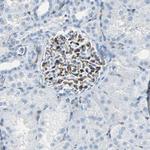 RPS13 Antibody in Immunohistochemistry (Paraffin) (IHC (P))