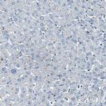 RPS13 Antibody in Immunohistochemistry (Paraffin) (IHC (P))