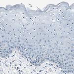 RPS13 Antibody in Immunohistochemistry (Paraffin) (IHC (P))