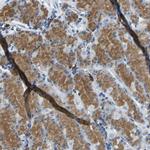 RPS13 Antibody in Immunohistochemistry (IHC)