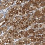 GLCCI1 Polyclonal Antibody