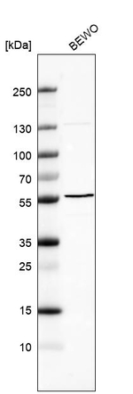 B3GNT2 Antibody in Western Blot (WB)