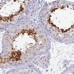 TEX33 Polyclonal Antibody