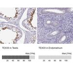 TEX33 Antibody in Immunohistochemistry (IHC)