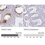 TEX33 Antibody