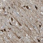 PHF16 Polyclonal Antibody