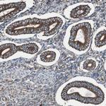 Calumenin Antibody in Immunohistochemistry (Paraffin) (IHC (P))