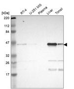 Calumenin Antibody in Western Blot (WB)