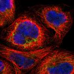 MTIF2 Polyclonal Antibody