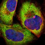 PPP2R5E Polyclonal Antibody