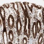 PPP2R5E Antibody in Immunohistochemistry (Paraffin) (IHC (P))