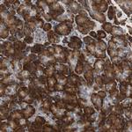 RPL35 Antibody in Immunohistochemistry (IHC)