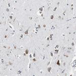 RPL35 Antibody in Immunohistochemistry (IHC)