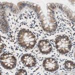 RPL35 Antibody in Immunohistochemistry (IHC)