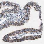 RPL35 Antibody in Immunohistochemistry (IHC)