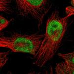 BBX Polyclonal Antibody