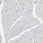 BBX Antibody in Immunohistochemistry (Paraffin) (IHC (P))