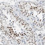 BBX Antibody in Immunohistochemistry (Paraffin) (IHC (P))